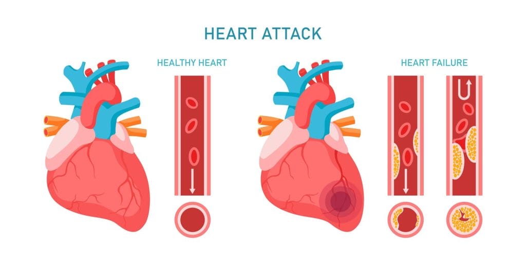plant-based-diet-helps-with-cardiovascular-health.